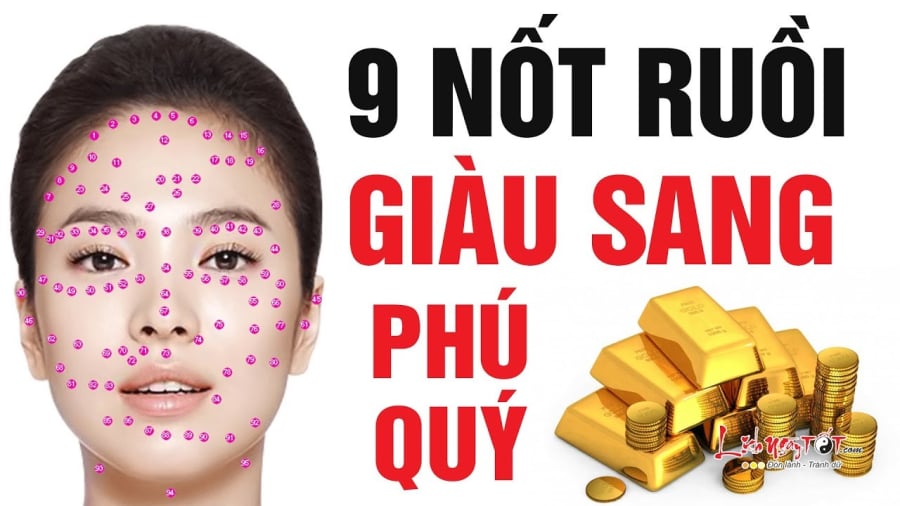 Nốt ruồi quý tướng