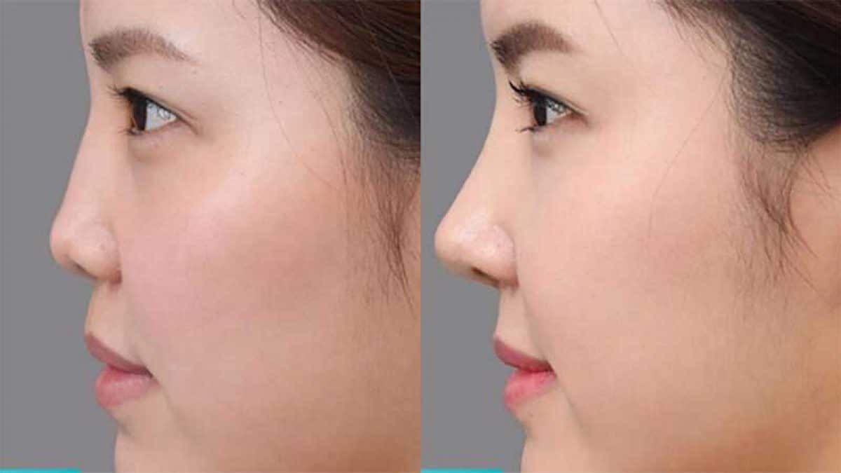 Dáng mũi trong nhân tướng học