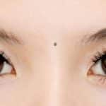 Vị trí nốt ruồi