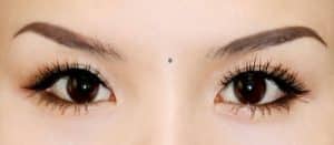 Vị trí nốt ruồi